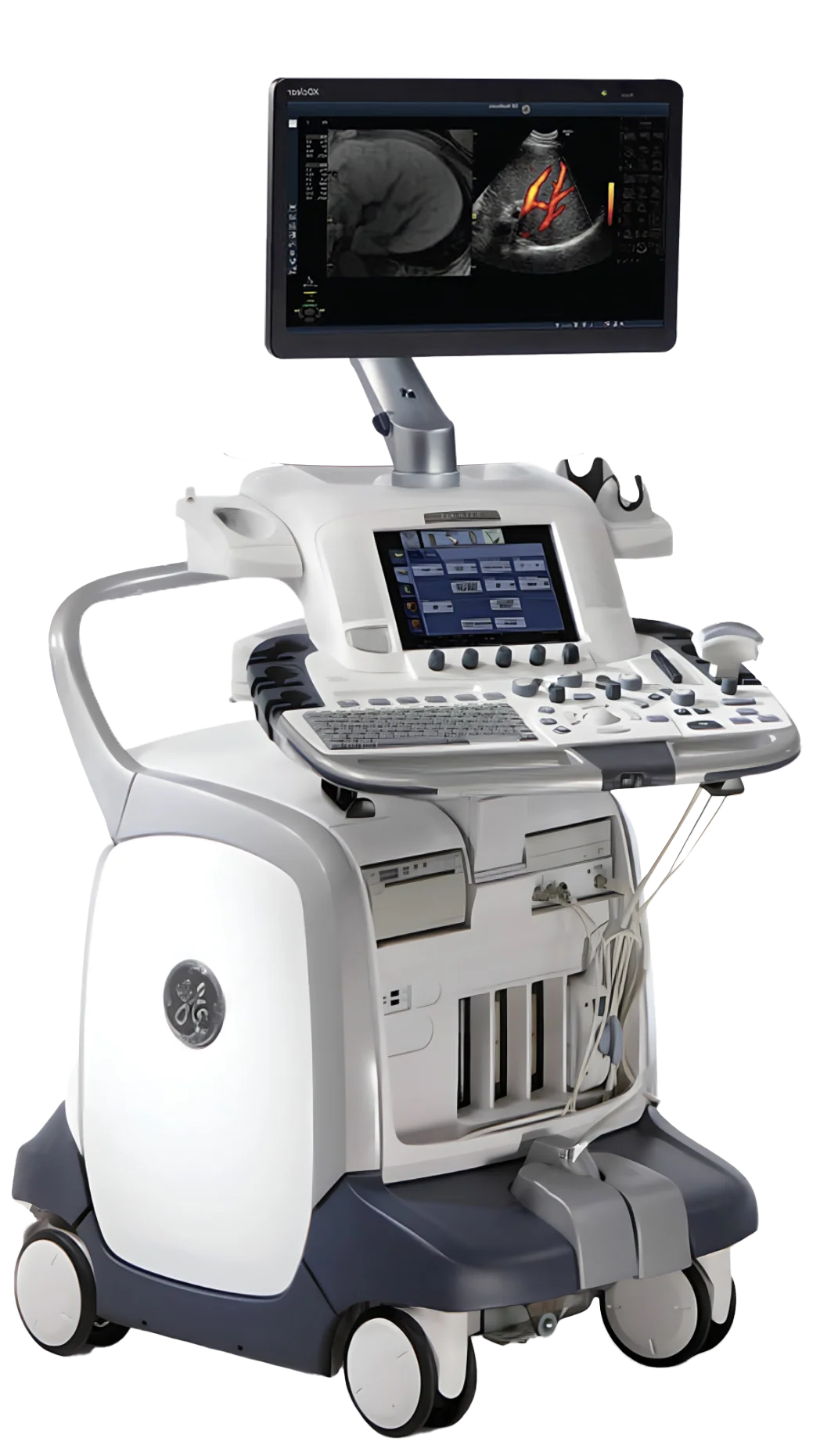 Usg machine